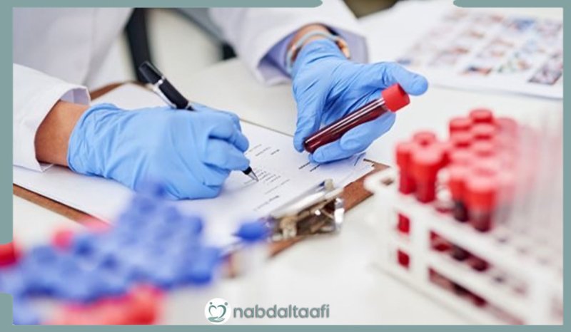 تحليل المخدرات أنواع المخدرات التي يكشف عنها 2 أنواع تحليل المخدرات