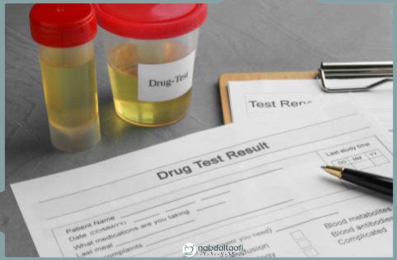 ما هو تحليل المخدرات للسائقين؟